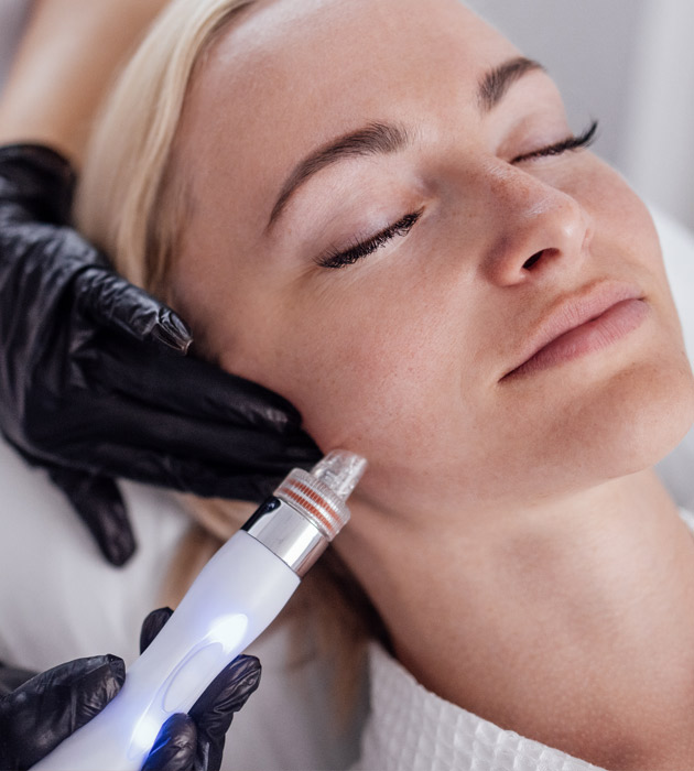 Trusted Microneedling Northampton